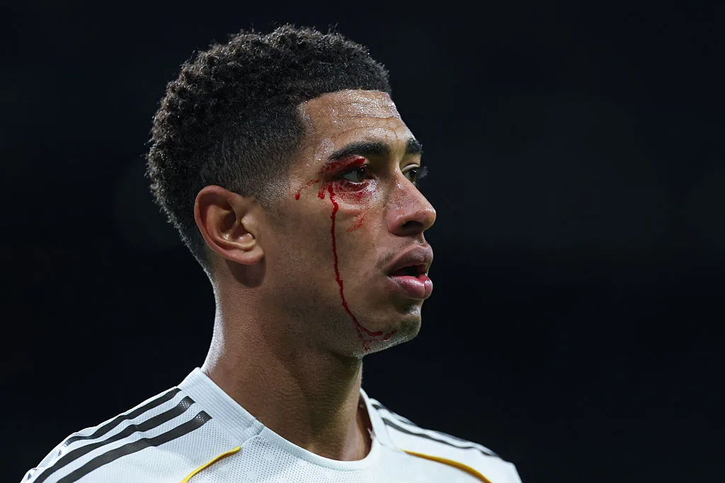 Καταστροφική Βραδιά για τη Ρεάλ: Ήττα, Τραυματισμοί και Αποβολές